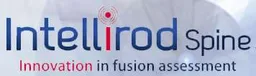 Intellirod Spine