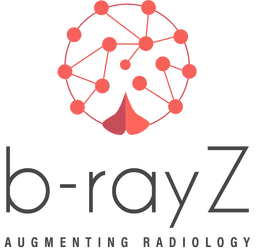 b-rayZ